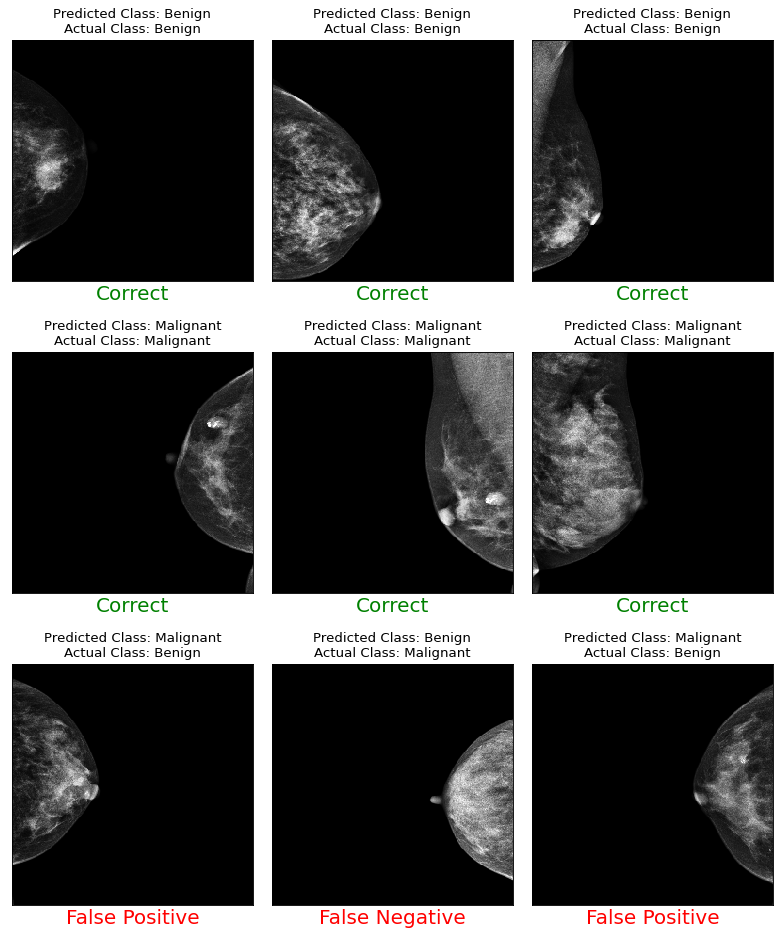 Mammography Classification with Deep Learning portfolio preview image